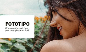 banner blog fototipo 1